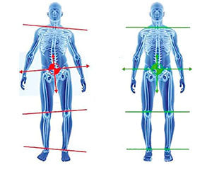 Superthotics a 199 LEU